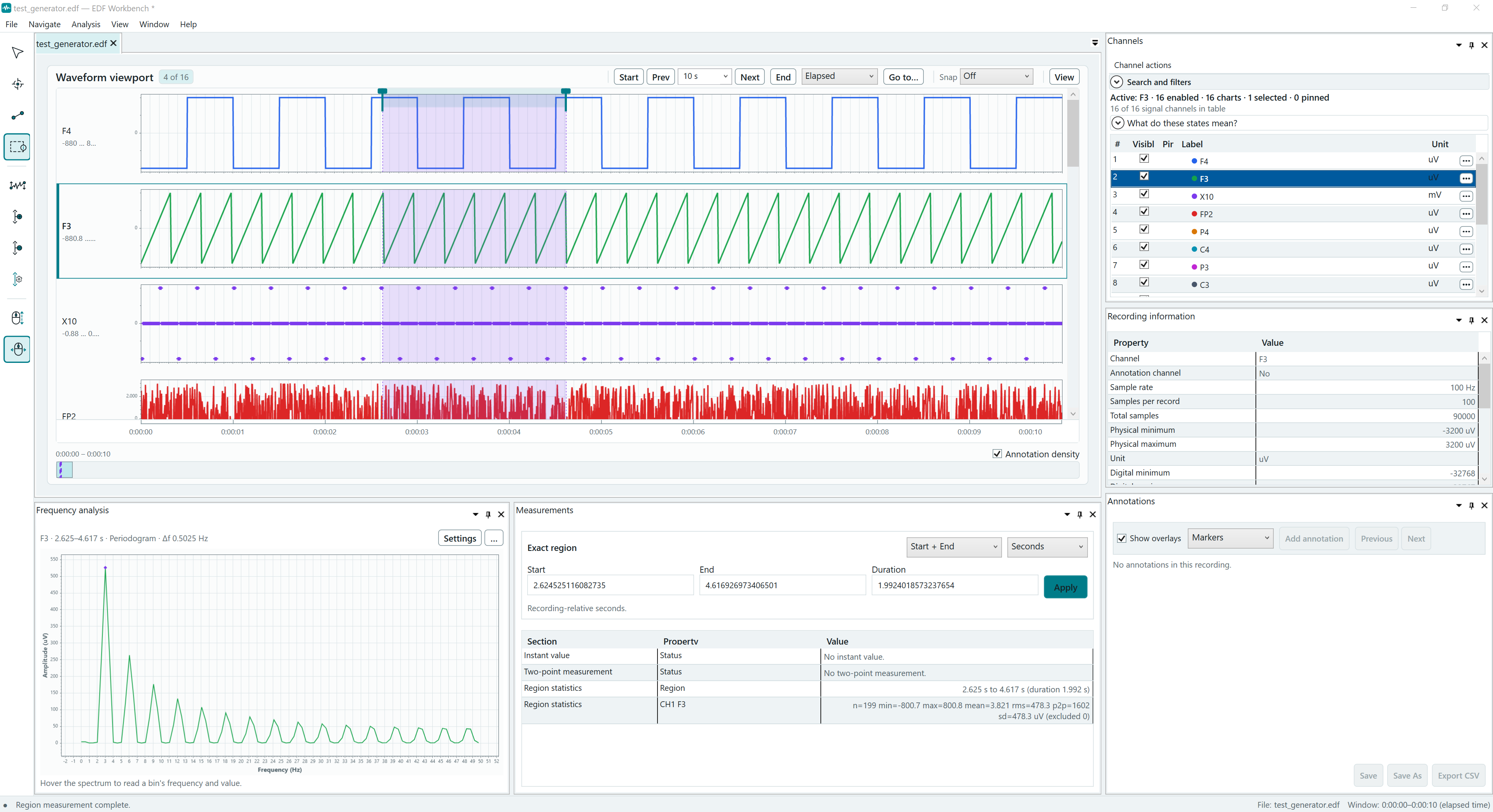 EDF Workbench displaying a synthetic recording with four waveform charts, Channels and Recording information panes, Frequency analysis, Measurements, and Annotations.